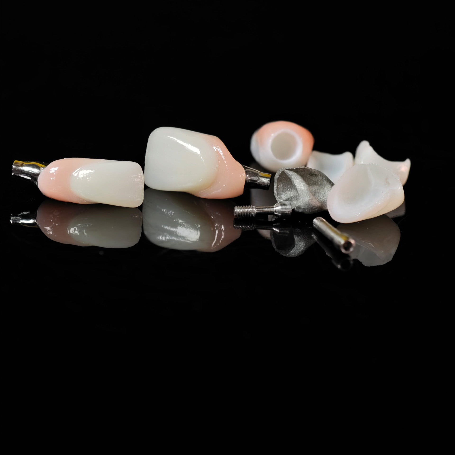 Zirconia Crown With Screw Retained And Cement Retained And Ceramic Veneers