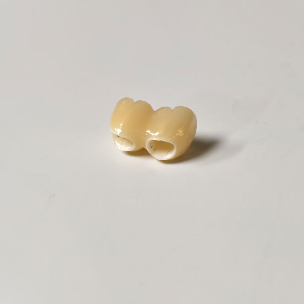 Zirconia Implant Bridge Screwmentable Dental Crown