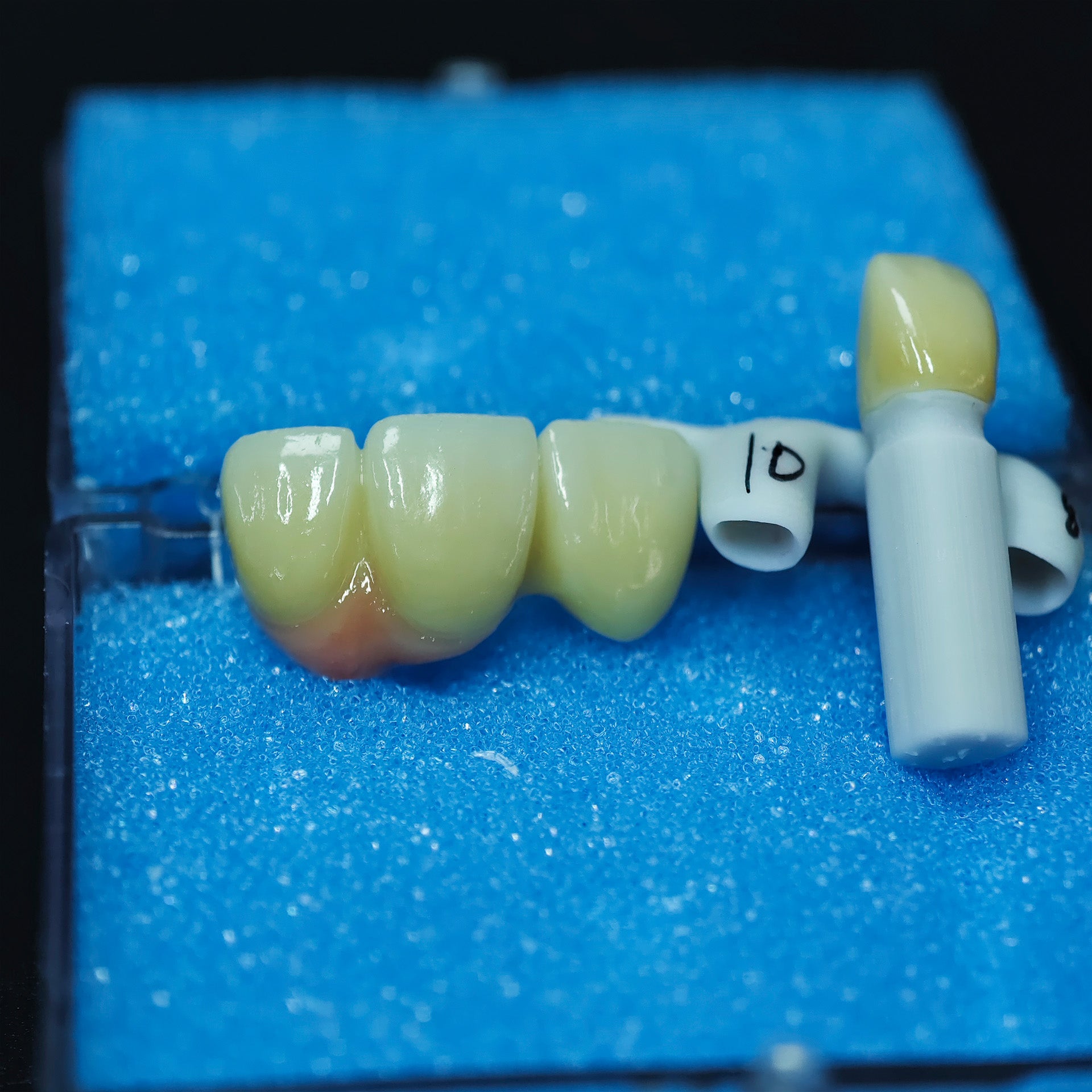 Zirconia Implant Bridge Screwmentable Dental Crown