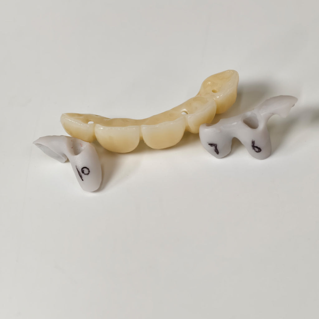 Zirconia Implant Bridge Screwmentable Dental Crown