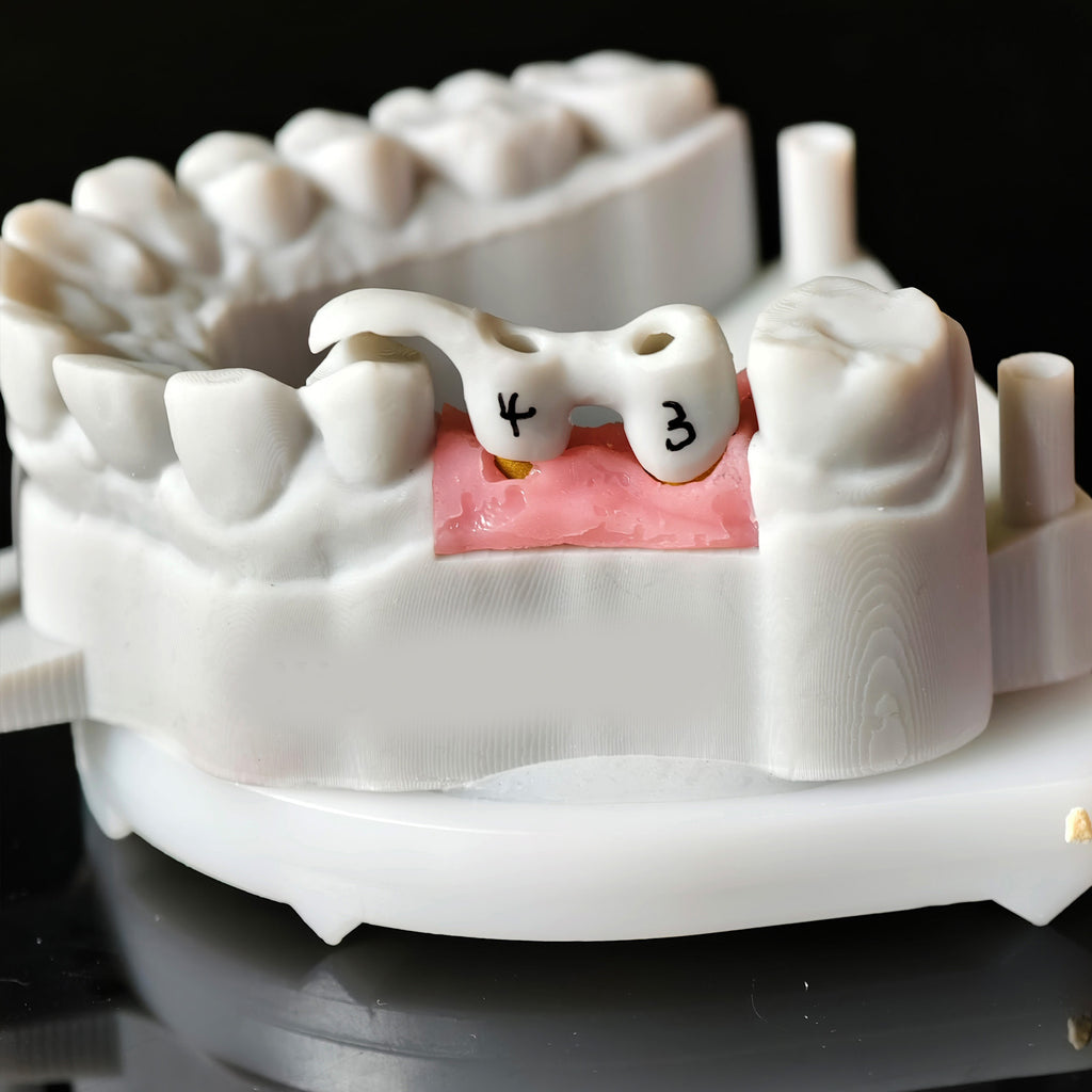 Zirconia Implant Bridge Screwmentable Dental Crown