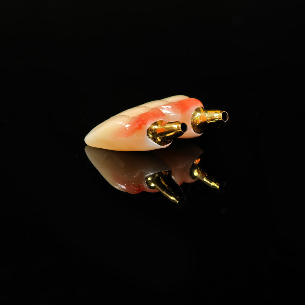 Zirconia Implant Bridge With Gold Plating