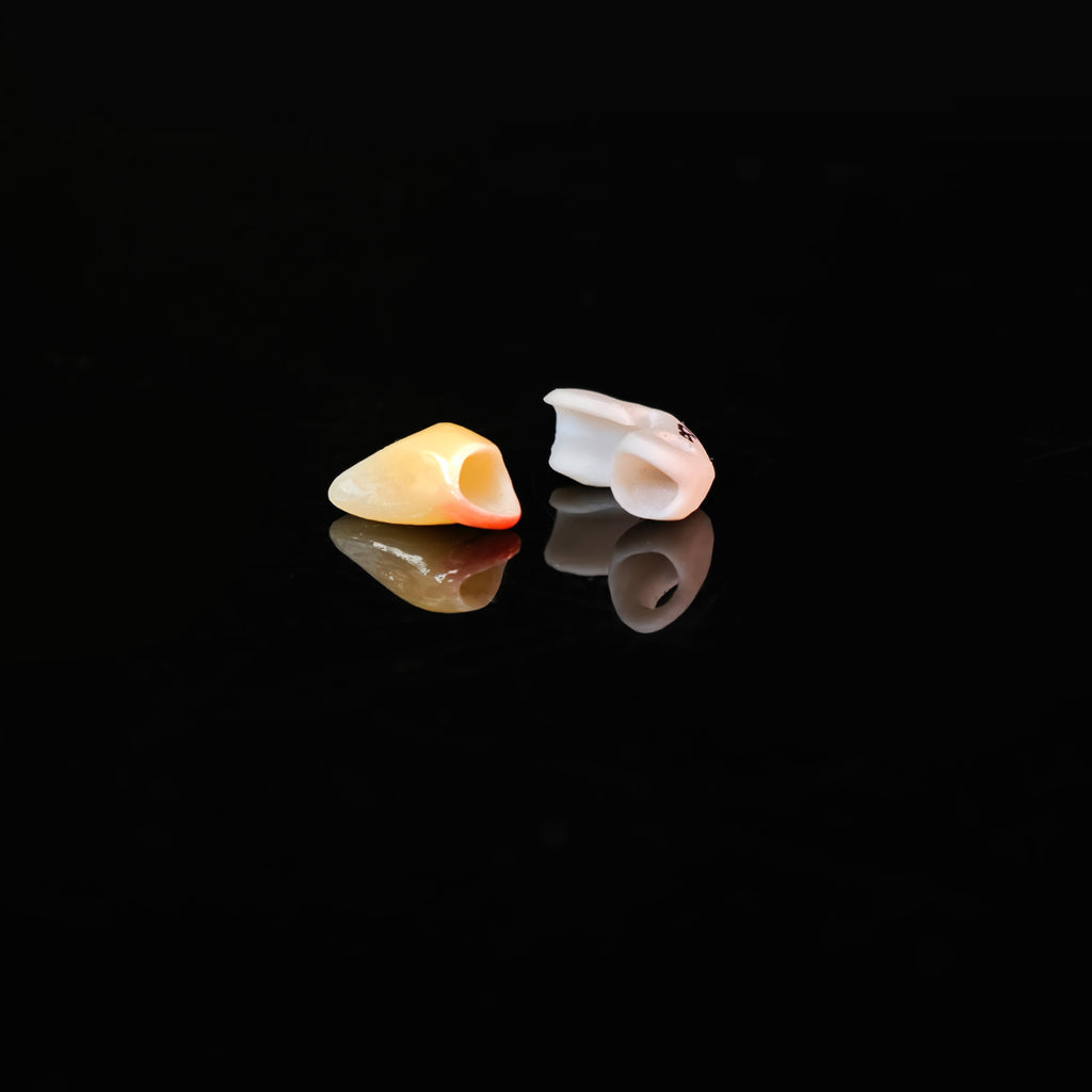Zirconia Implant Crown Screwmentable Dental Crown