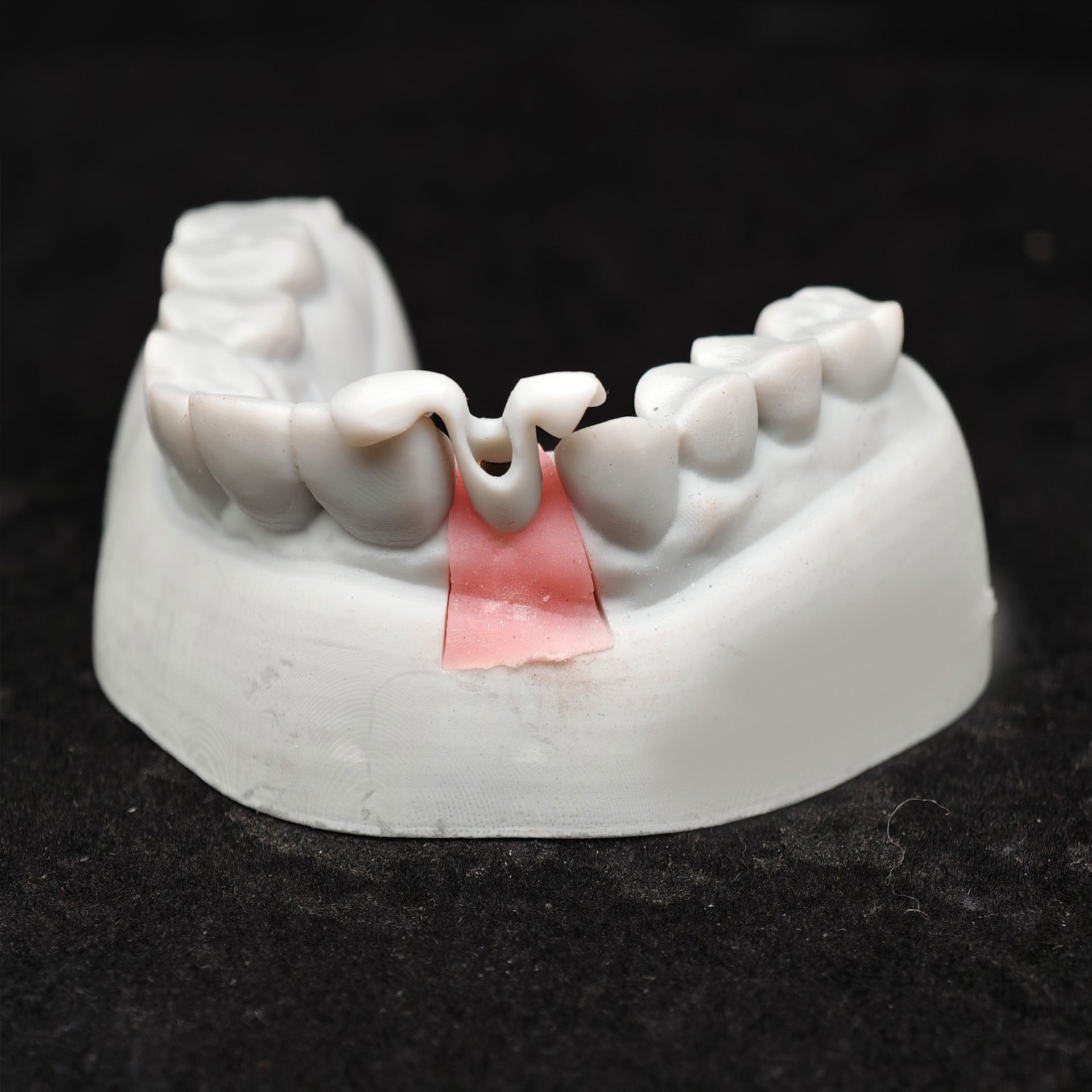 Zirconia Implant Crown Screwmentable Dental Crown