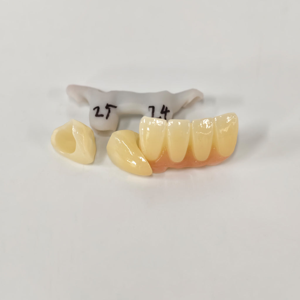 Zirconia Implant Crown And Bridge Screwmentable Dental Crown