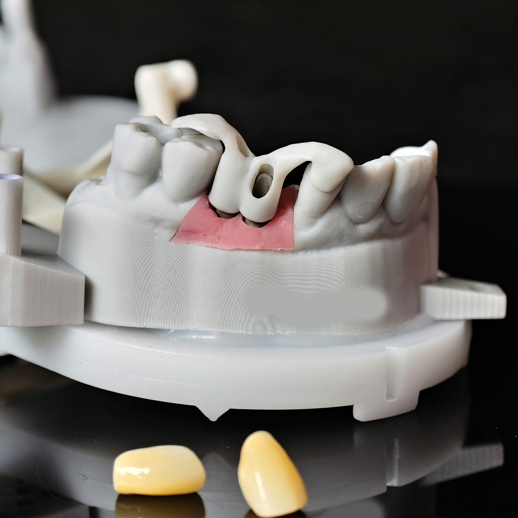 Zirconia Implant Crowns Screwmentable Dental Crown With Gold Plating