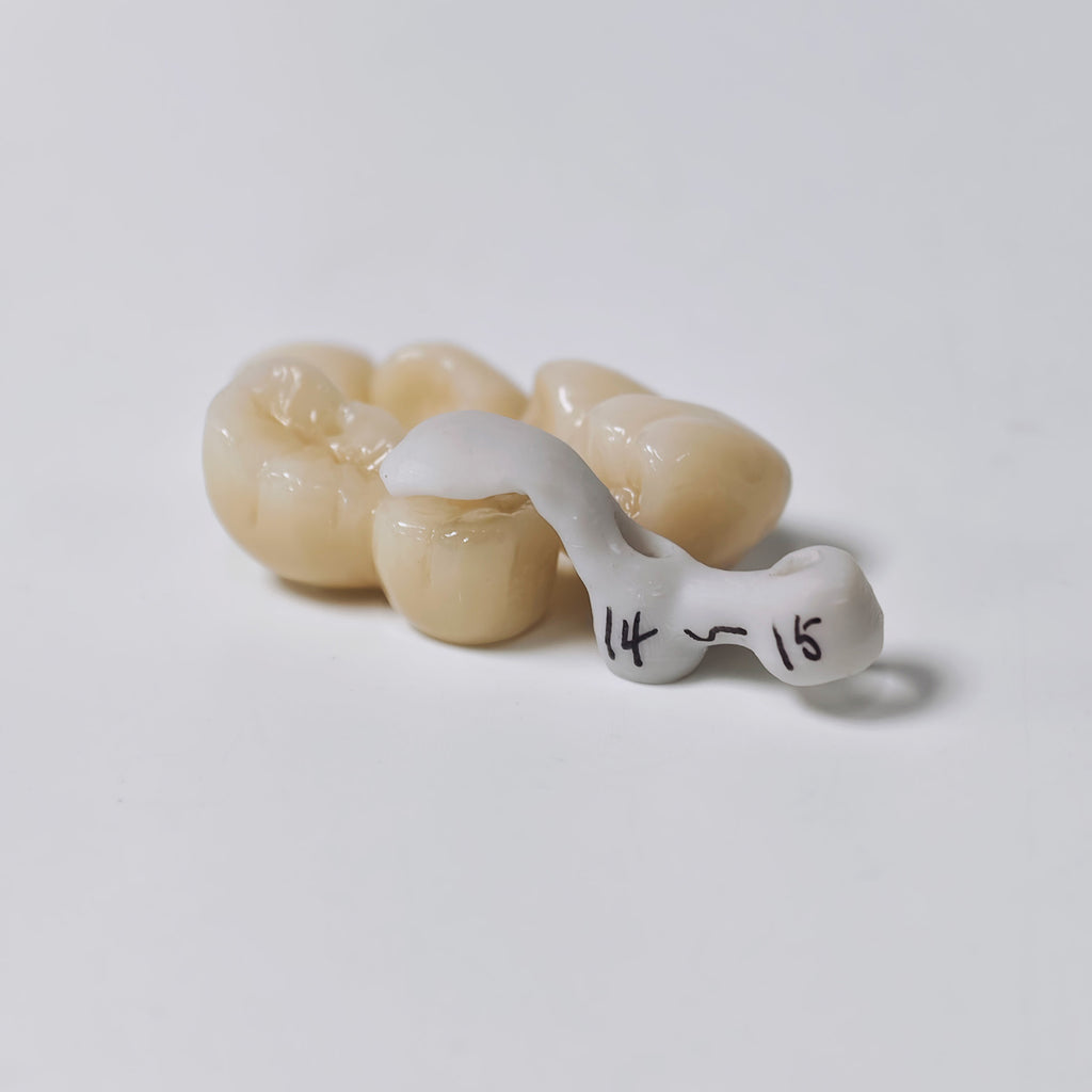 Zirconia Implant Crowns And Bridges Screwmentable Dental Crown