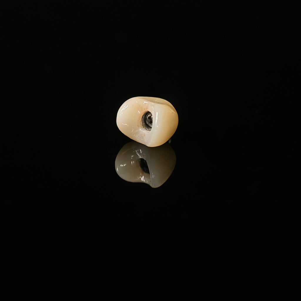 Zirconia Implant Crown With Gold Plating