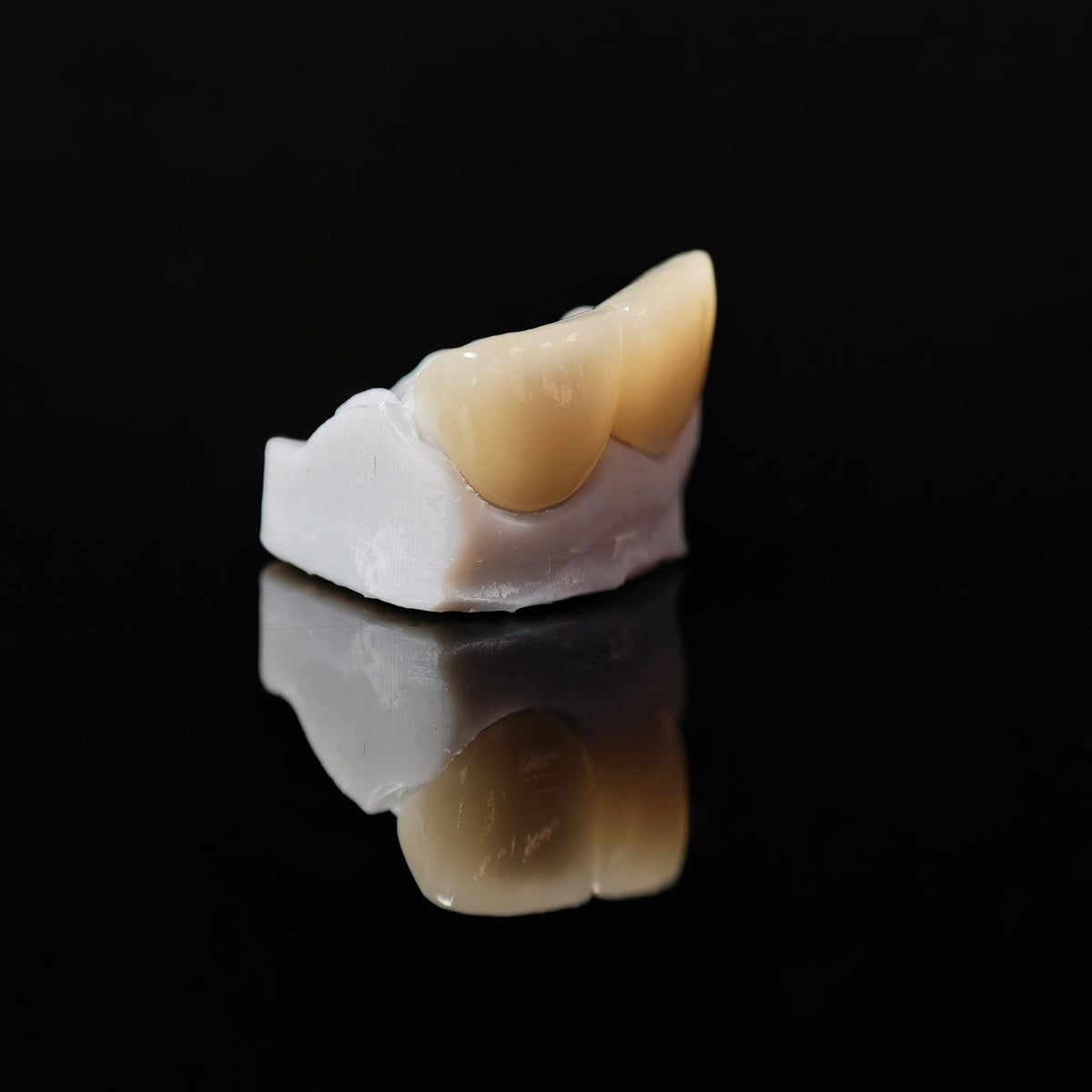 Zirconia Veneer. High Transparency/Translucent, Natural Shade