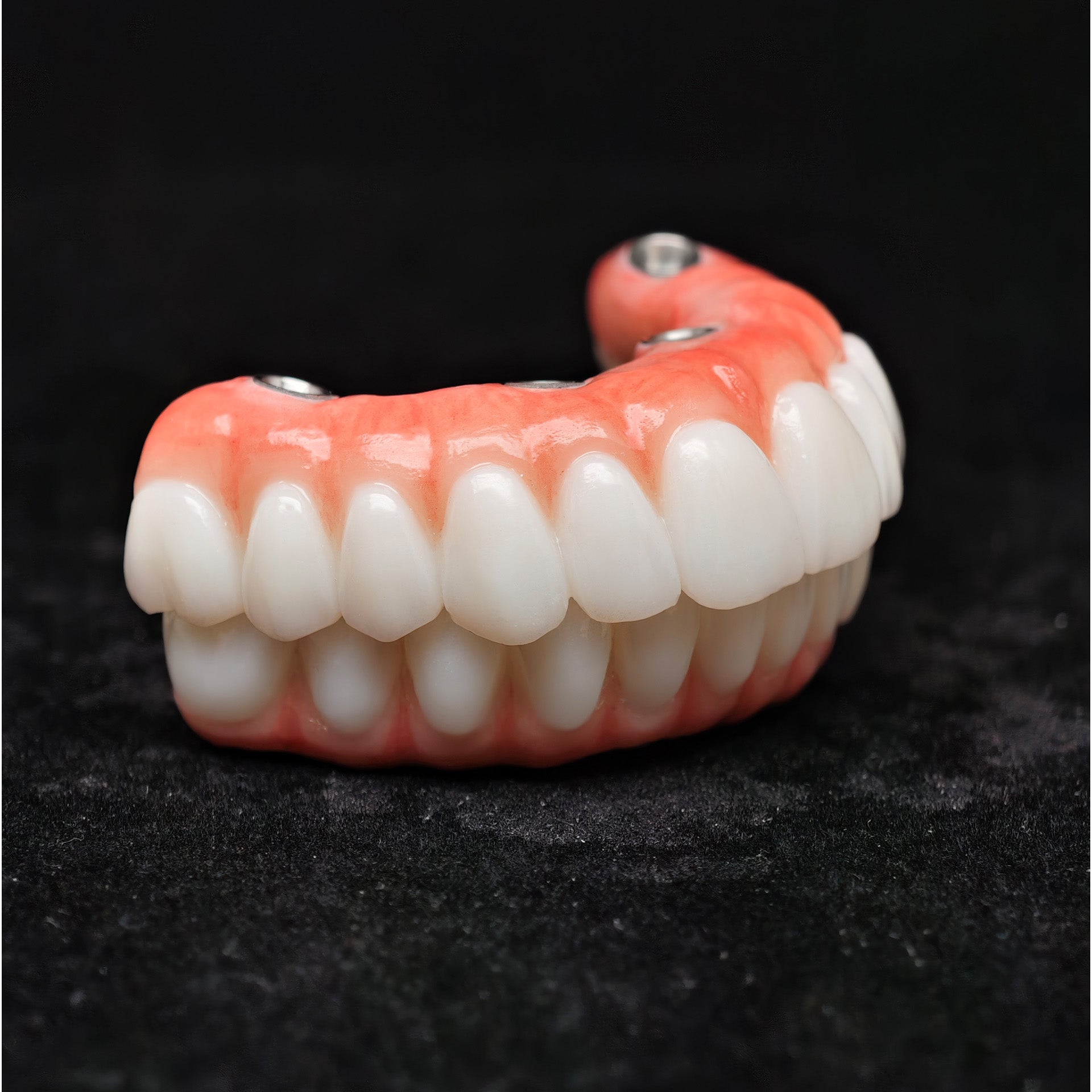 All On 4 Zirconia Bridge With Ti-Base Screw Retained Trying For Full Arch Restoration