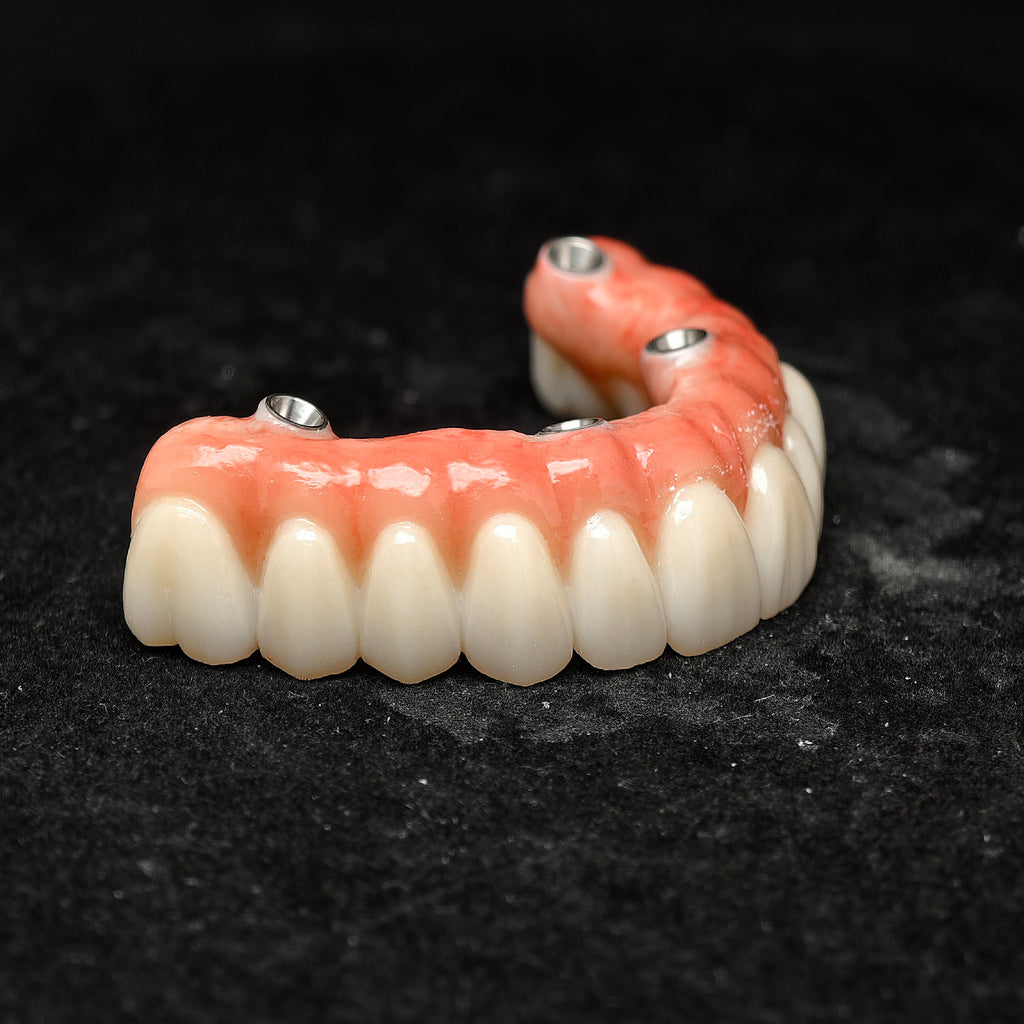 All On 4 Zirconia Bridge With Ti-Base Screw Retained Trying For Full Arch Restoration