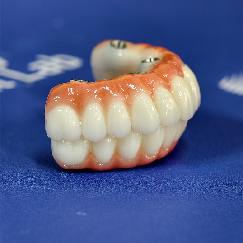 All On 4 Zirconia Bridge With Ti-Base Screw Retained Trying For Full Arch Restoration