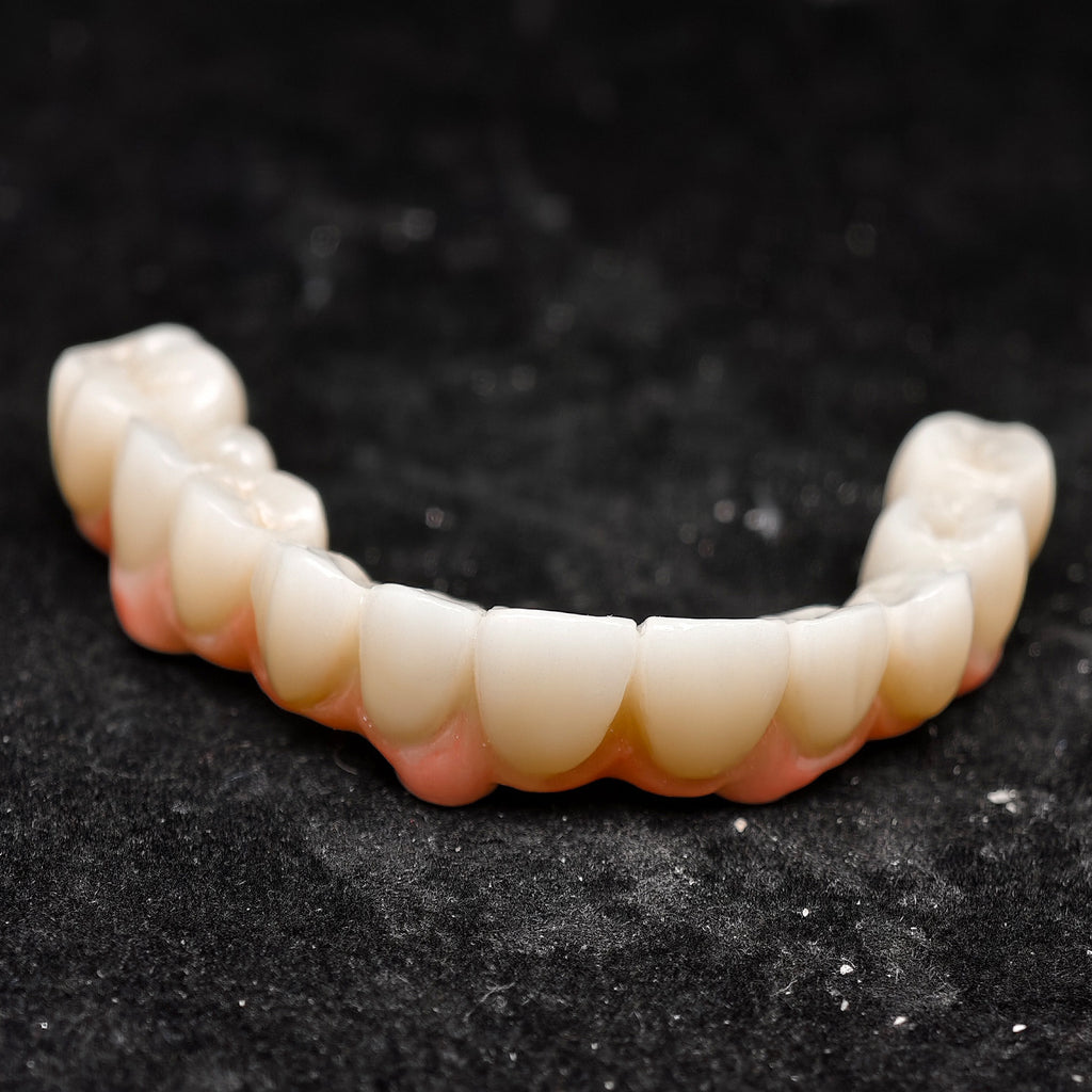 All On 4 Zirconia Bridge With Ti-Base Screw Retained Trying For Full Arch Restoration