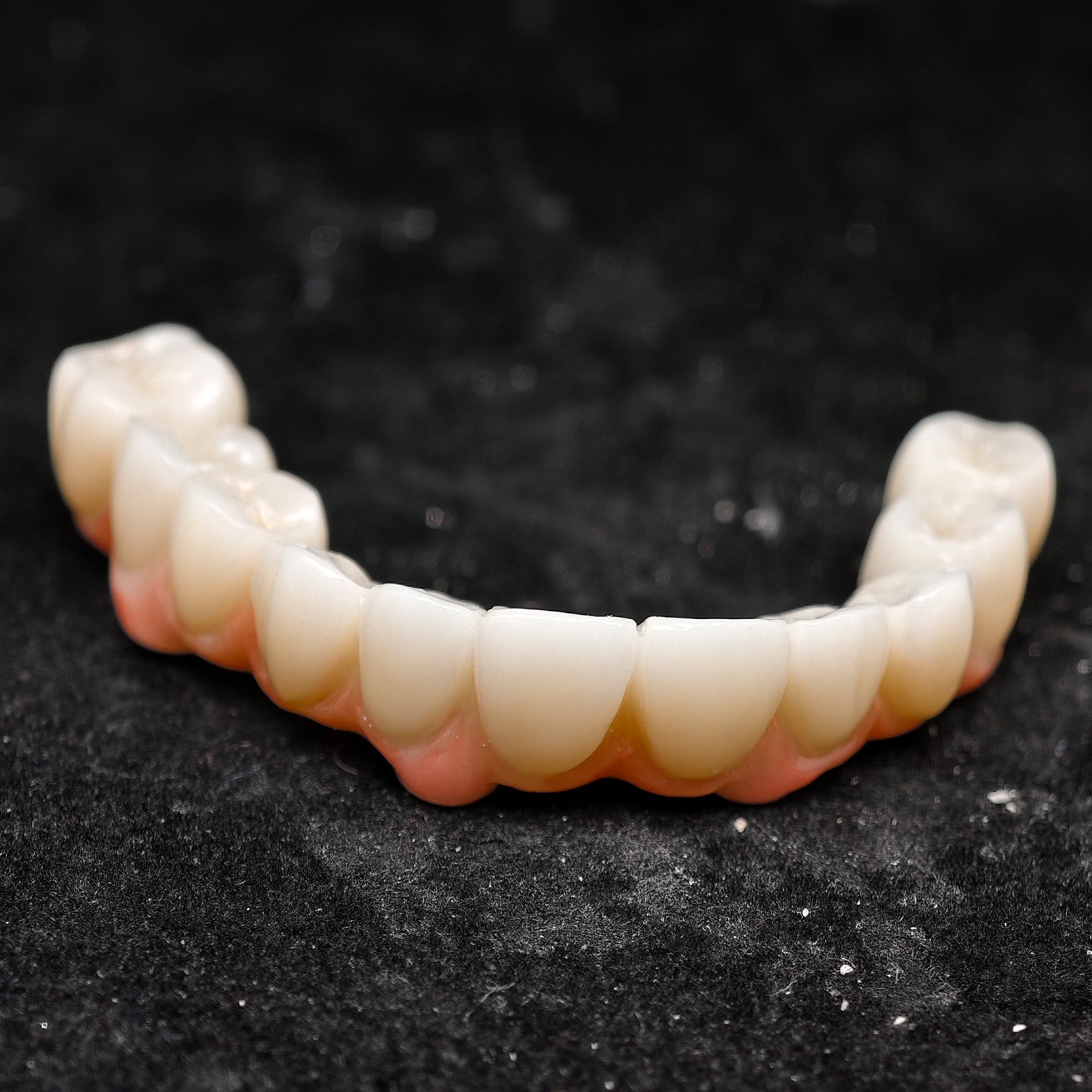 All On 4 Zirconia Bridge With Ti-Base Screw Retained Trying For Full Arch Restoration