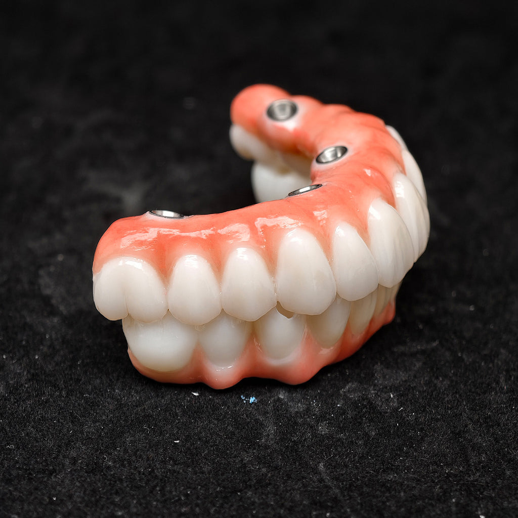 All On 4 Zirconia Bridge With Ti-Base Screw Retained Trying For Full Arch Restoration