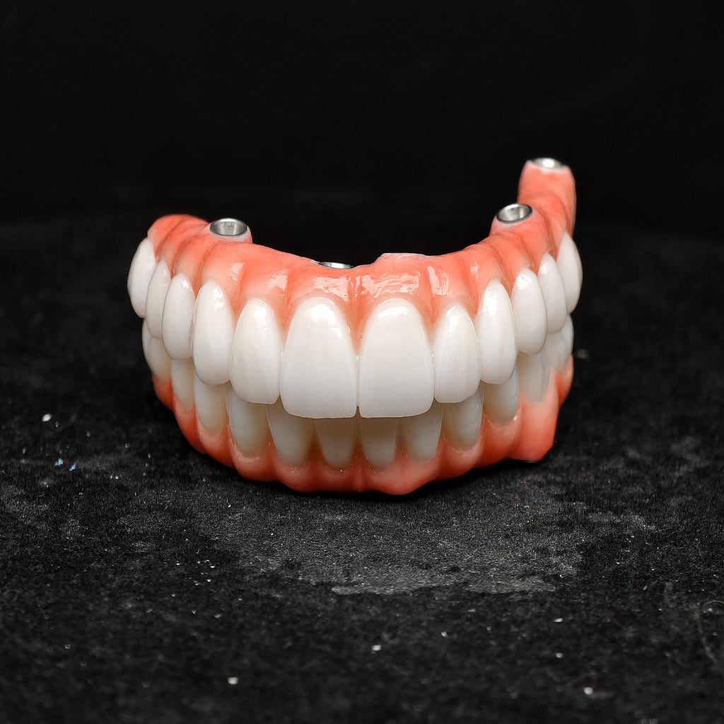 All On 5 Zirconia Bridge With Ti-Base Screw Retained Trying For Full Arch Restoration