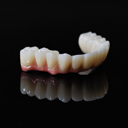 All On 5 Zirconia Bridge With Ti-Base Screw Retained Trying For Full Arch Restoration