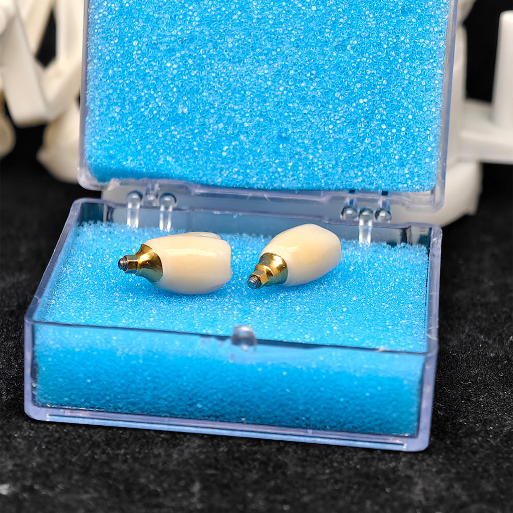 Custom Zirconia Implant Crowns