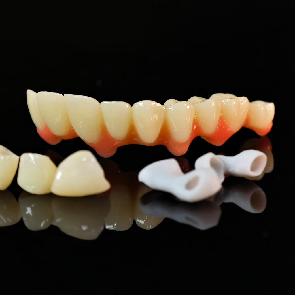 Custom Abutment And PMMA Bridge And Crown With Cement Retained