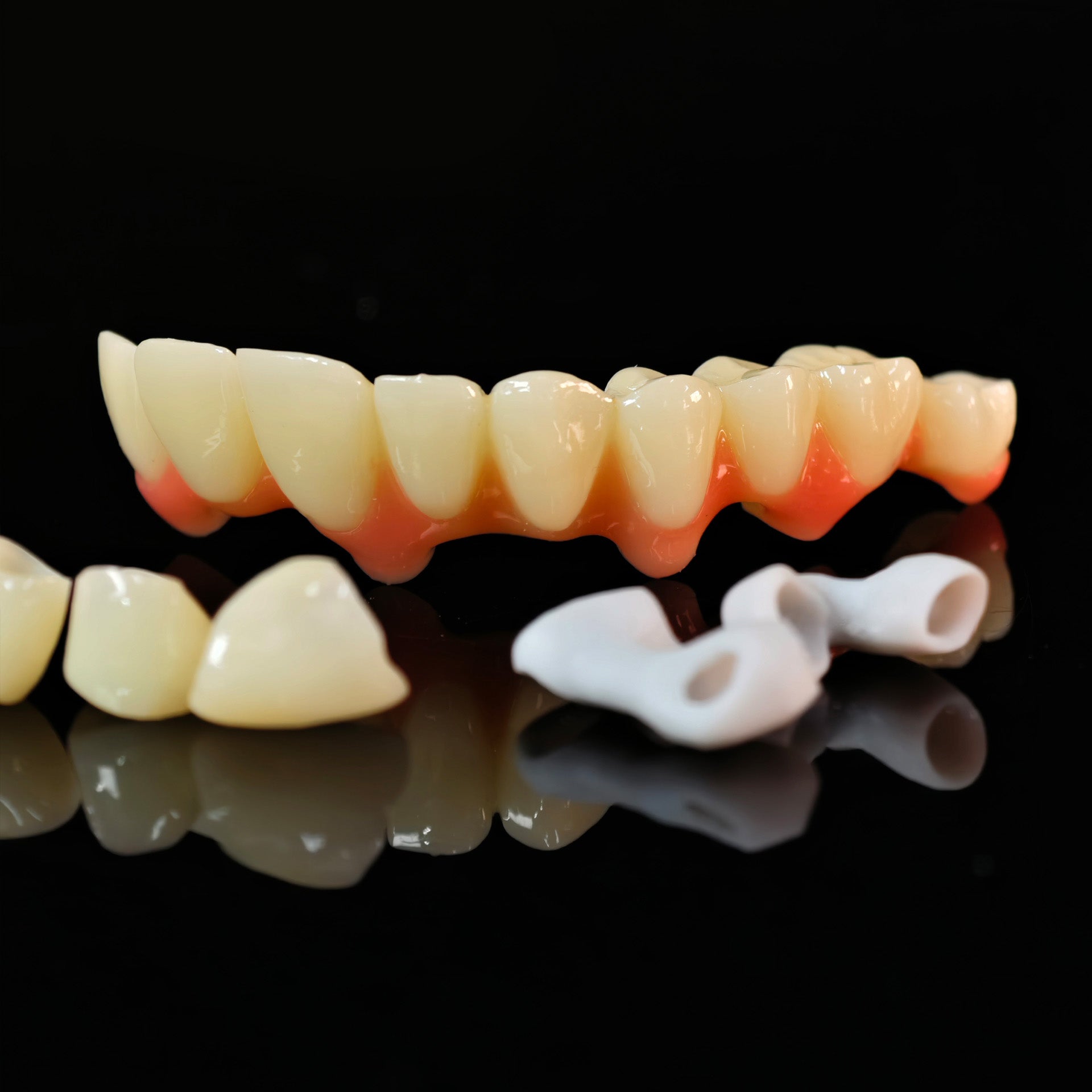 Custom Abutment And PMMA Bridge And Crown With Cement Retained