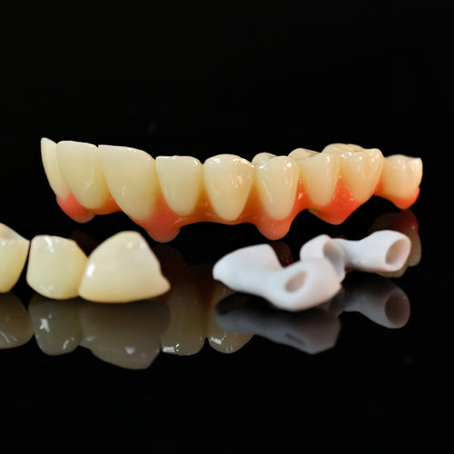 Custom Abutment And PMMA Bridge And Crown With Cement Retained
