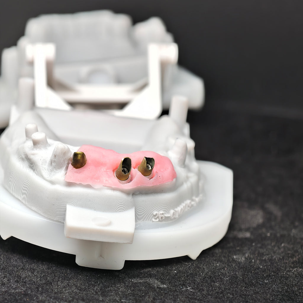 Custom Abutment With Zirconia Crown And Bridge