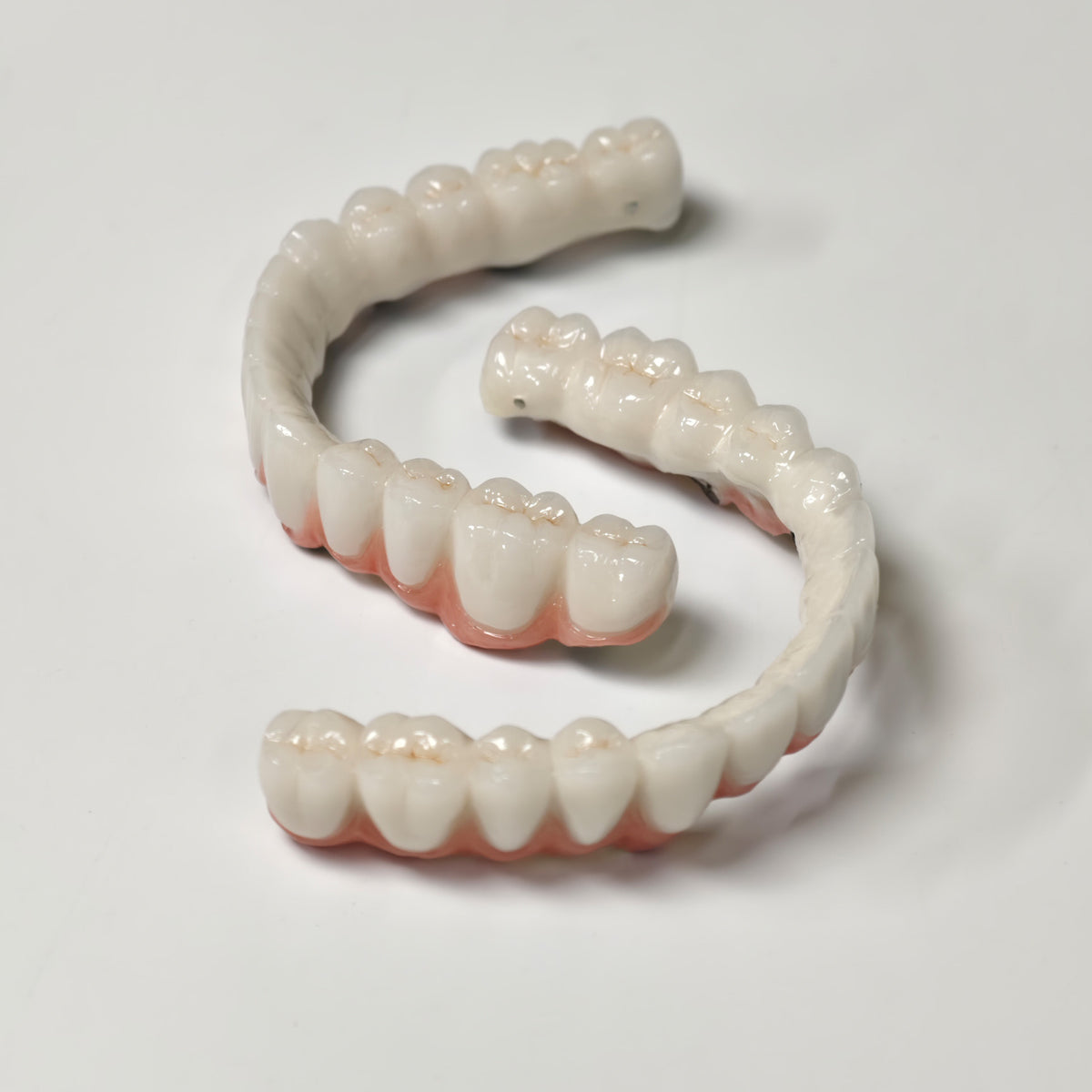 Full-Arch PFM Bridge With Screw Retained