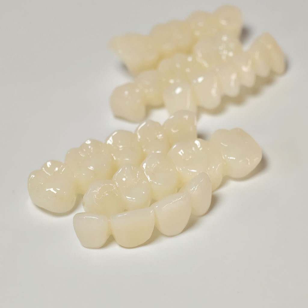Full-Mouth Segmented PMMA Bridge With Cement Retained