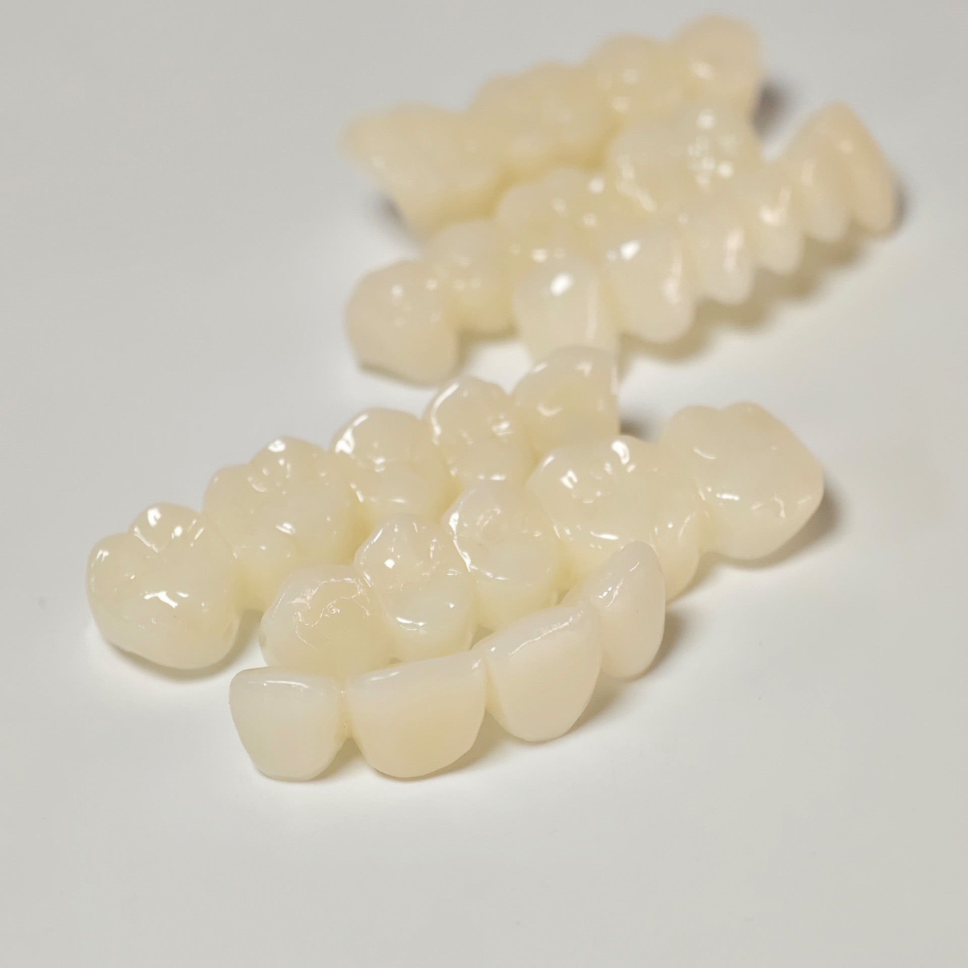 Full-Mouth Segmented PMMA Bridge With Cement Retained