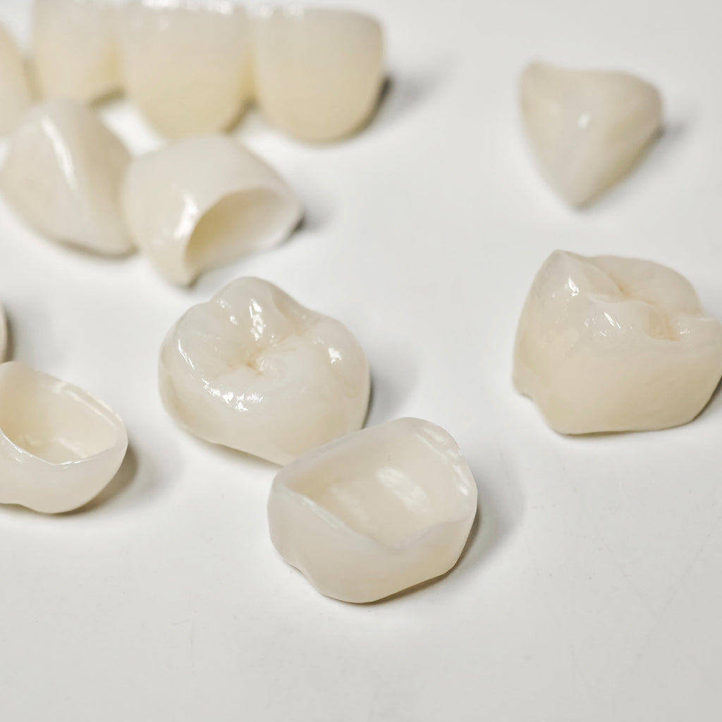 Full-Zriconia Crowns With Cement-Retained