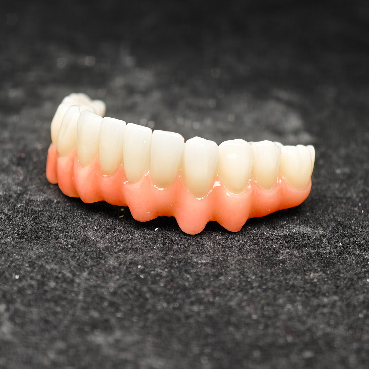 Pmma Bridge And Zirconia Bridge With Cemented