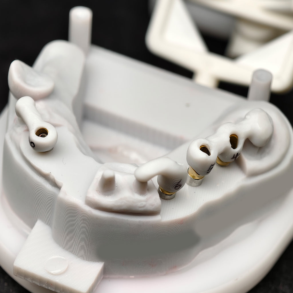 Zirconia Crown And Birdge With Cemented And Implant Seating Guide