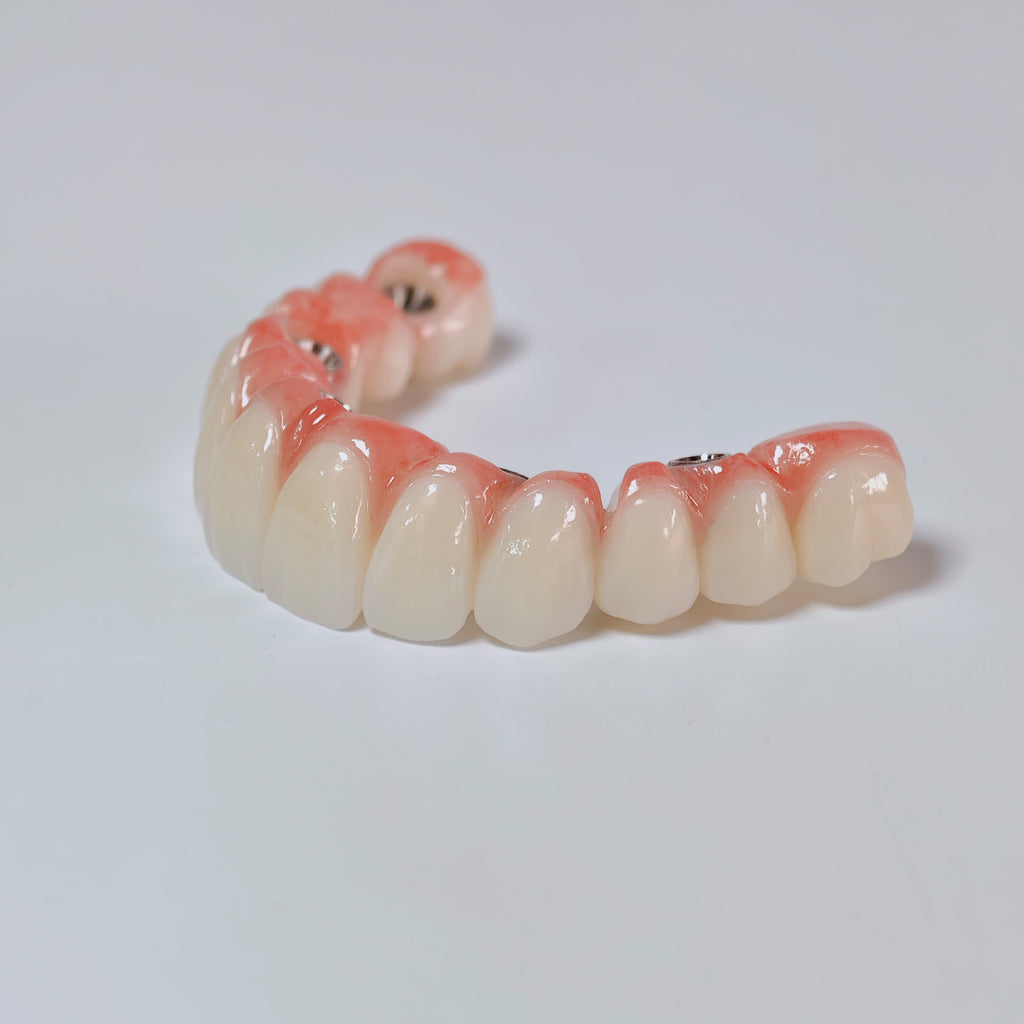 All On 6 Zirconia Bridge With Ti-Base Screw Retained