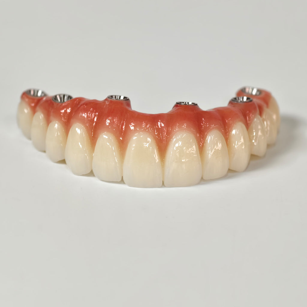 All On 6 Zirconia Bridge With Ti-Base Screw Retained