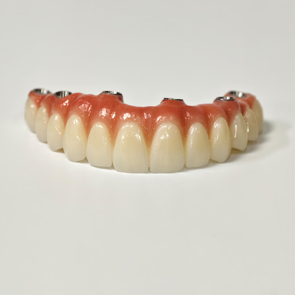 All On 6 Zirconia Bridge With Ti-Base Screw Retained