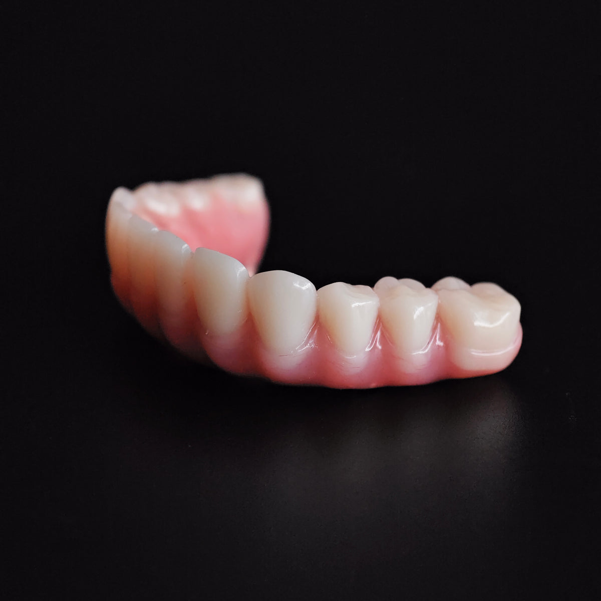 An Acrylic Denture With A Titanium Bar (Ti-Bar) Cost-Effective Full Arch Restoration Screw Retained