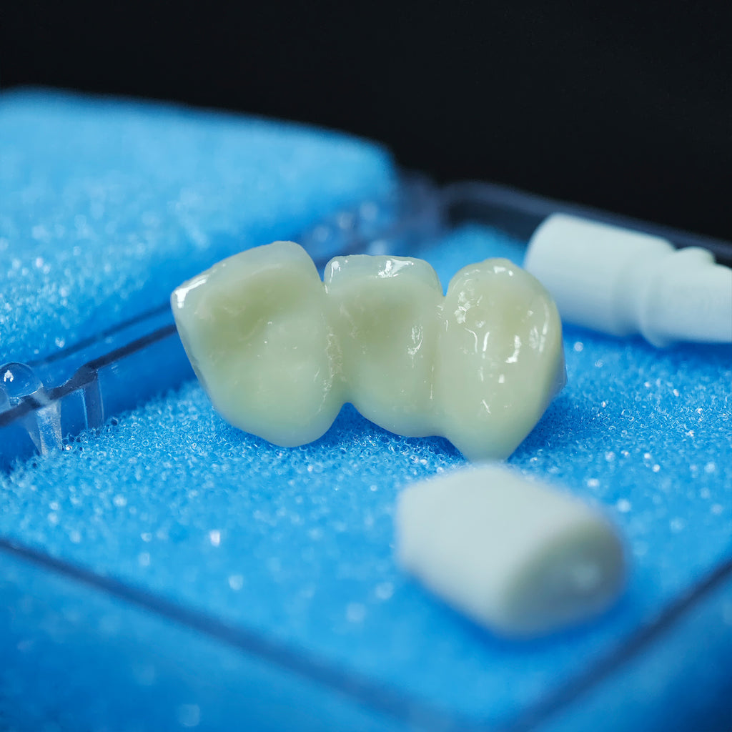 Beautiful Zirconia Bridge