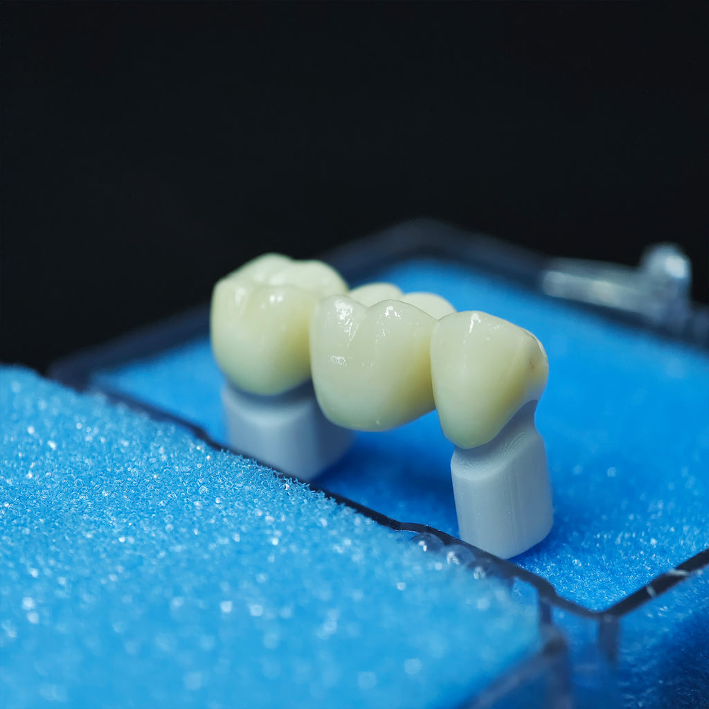 Beautiful Zirconia Bridge