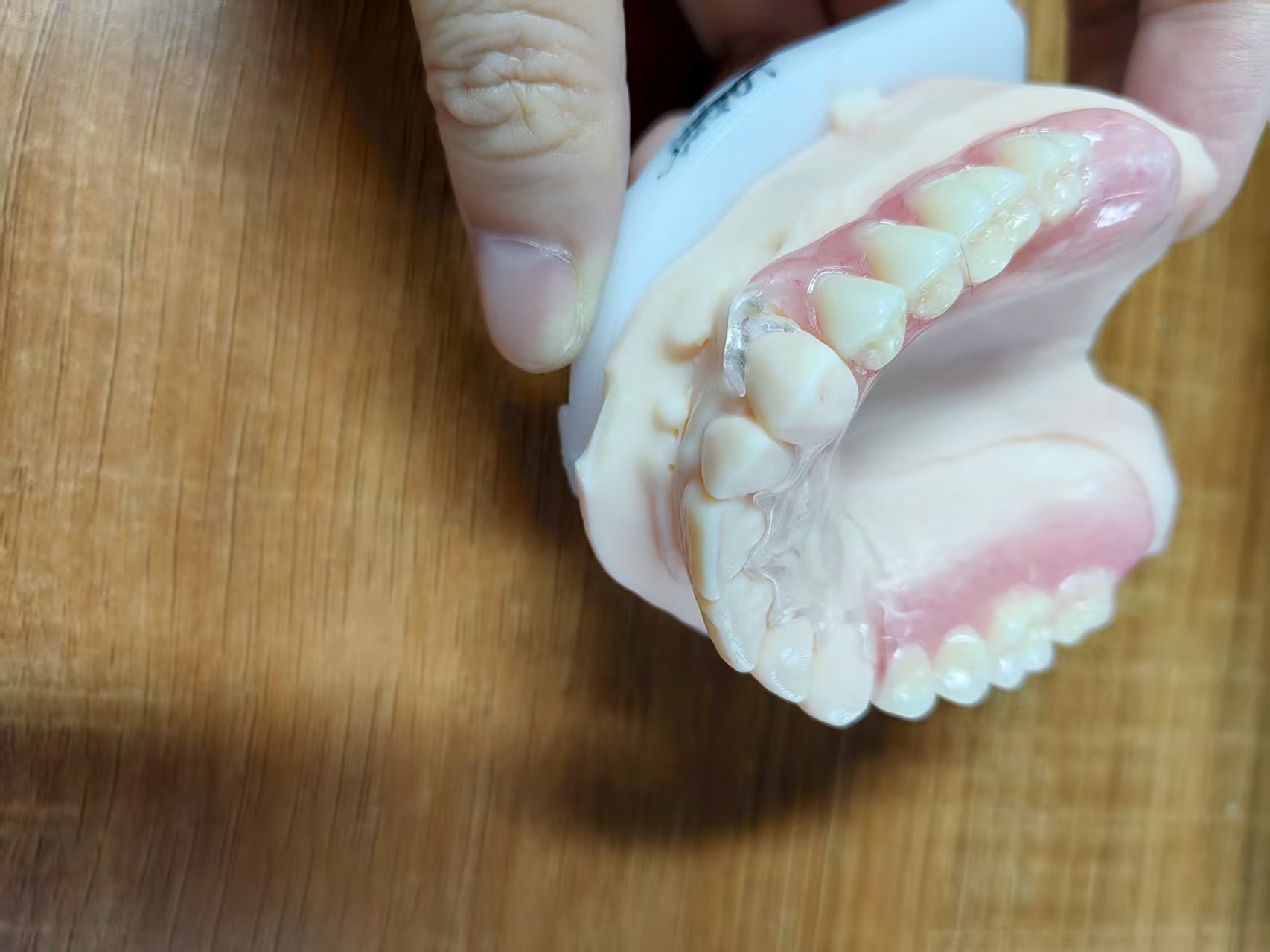 Clear Framework With Acrylic Denture Aesthetic Denture Dental Lab In China