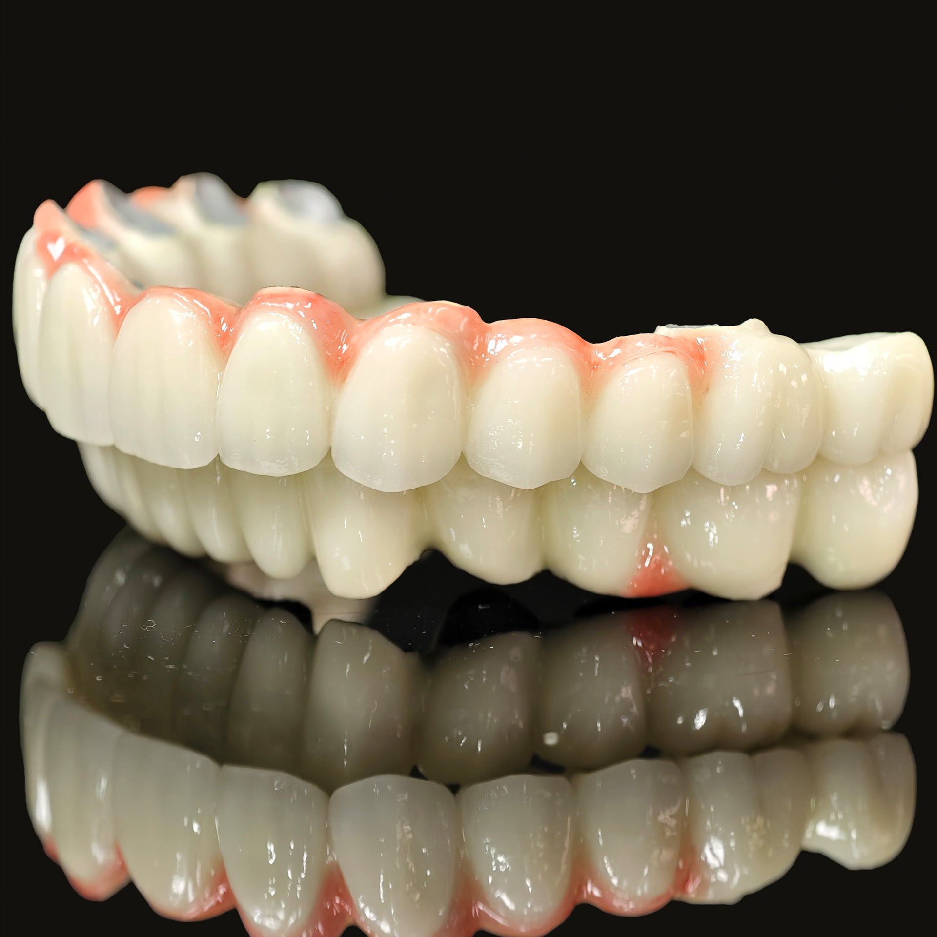 Co - Cr PFM Dental Bridge