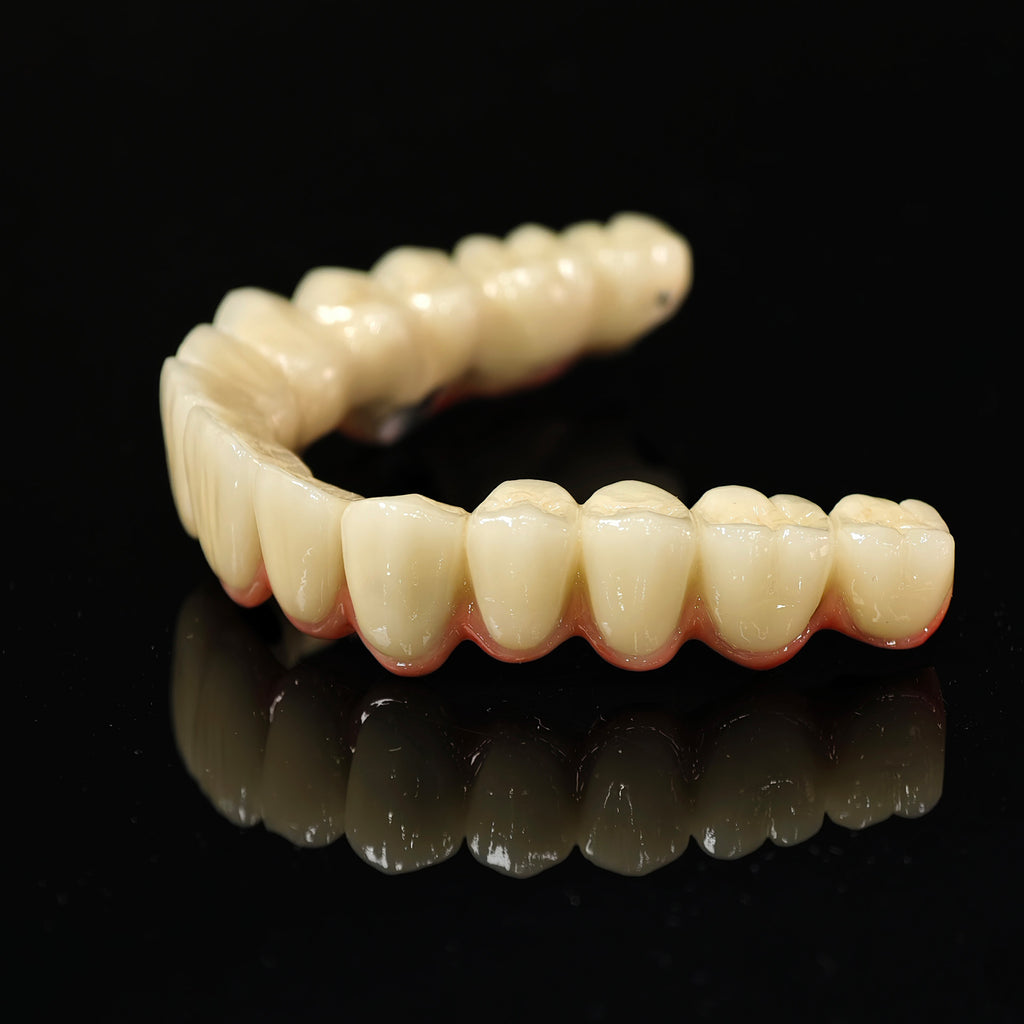 Co - Cr PFM Dental Bridge