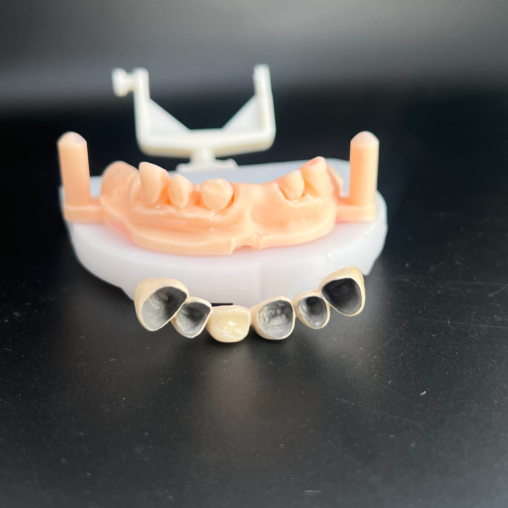 Co - Cr PFM Dental Bridge