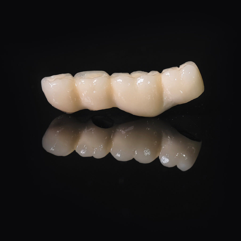 Co - Cr PFM Dental Bridge