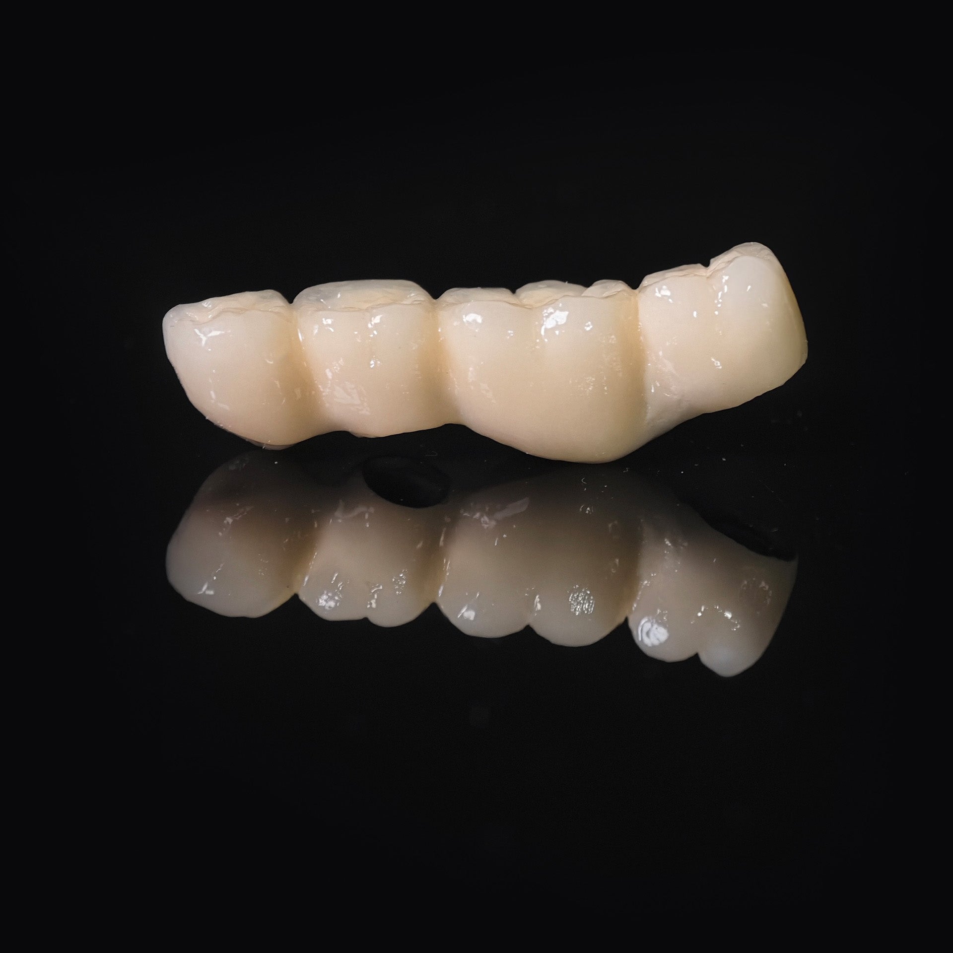 Co - Cr PFM Dental Bridge