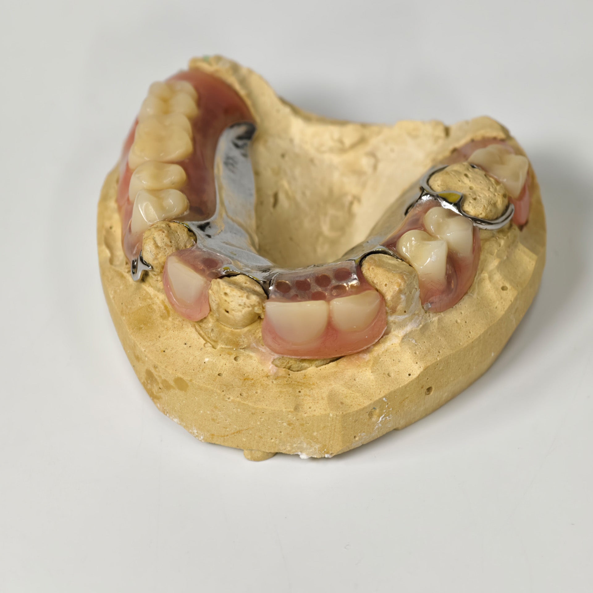 Cobalt Chrome Framework Denture Metal Framework With Acrylic Denture