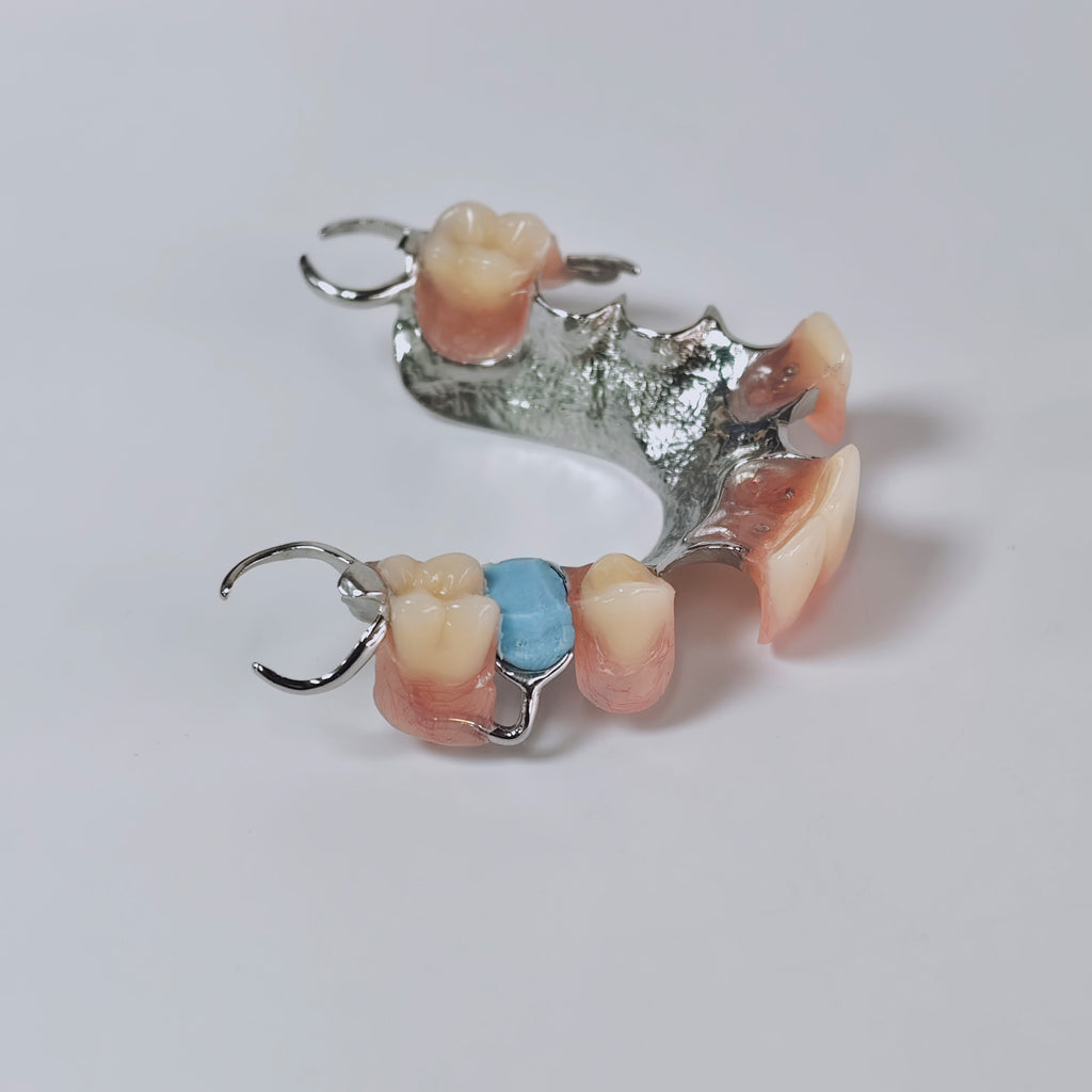 Cobalt Chrome Framework Denture Metal Framework With Acrylic Denture