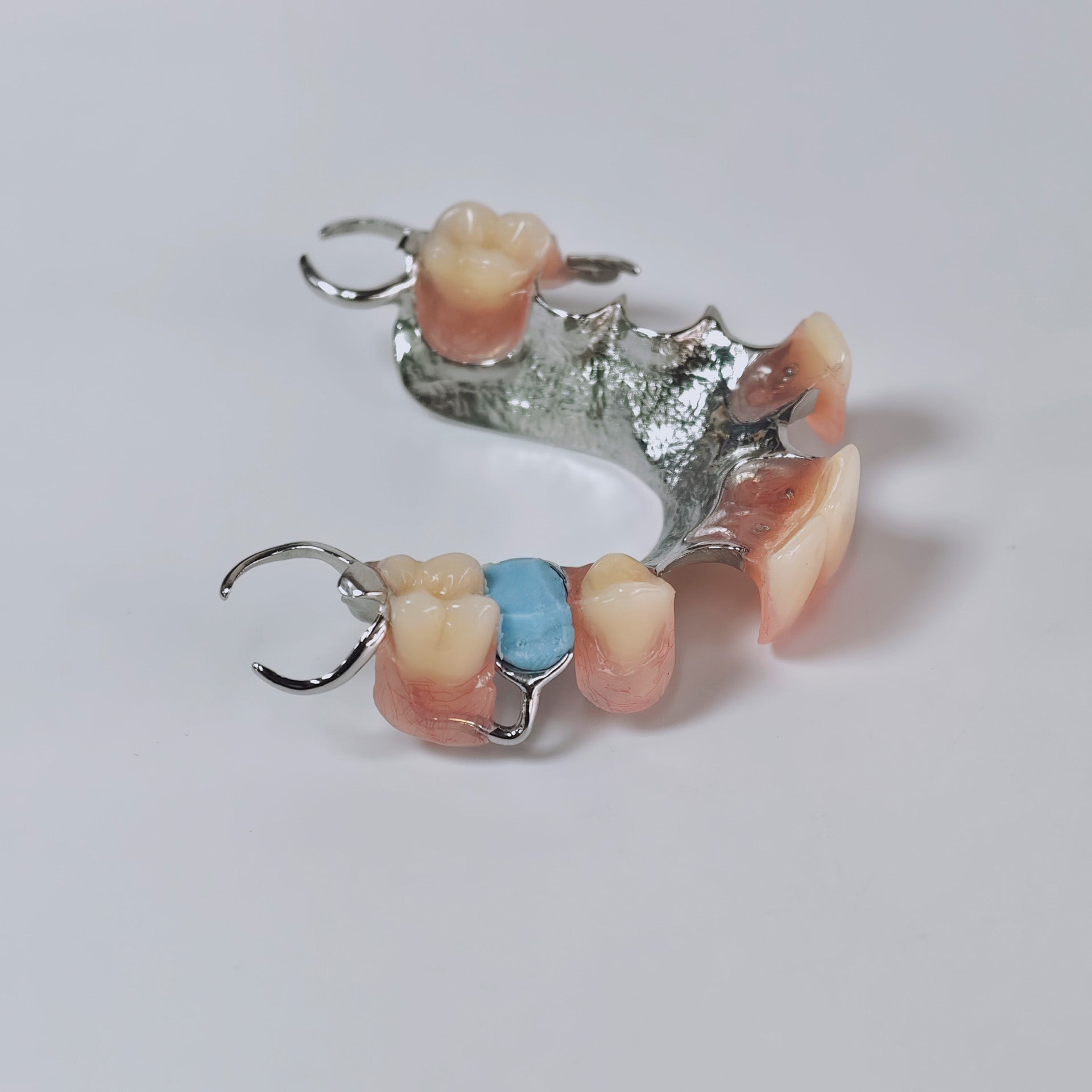 Cobalt Chrome Framework Denture Metal Framework With Acrylic Denture