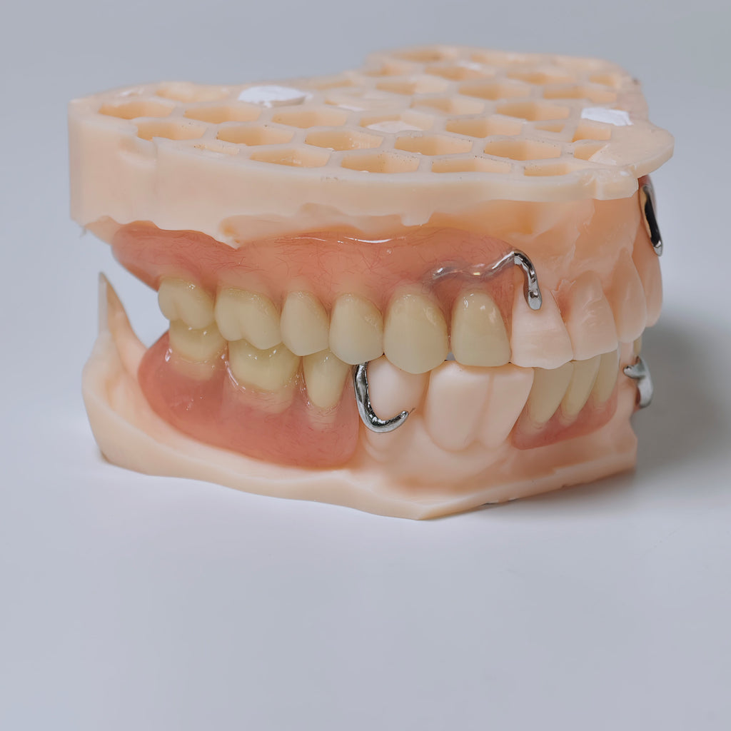 Cobalt Chrome Framework Denture Metal Framework With Acrylic Denture
