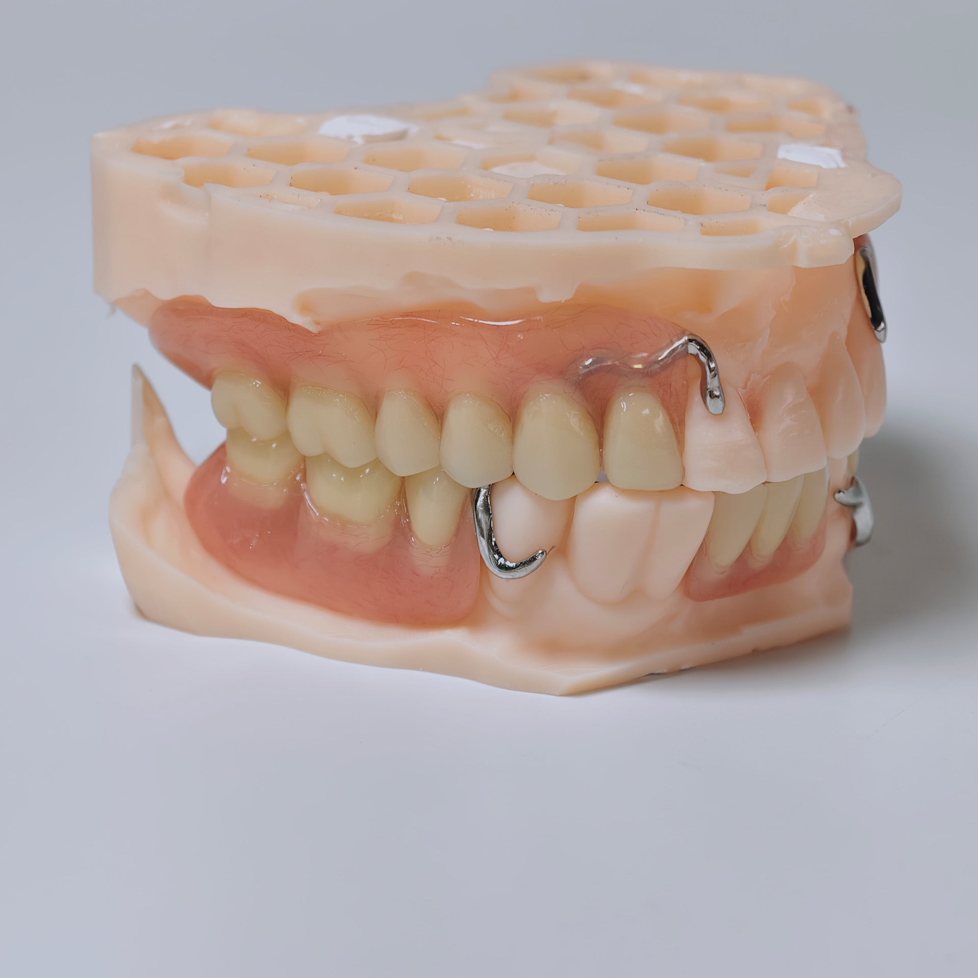 Cobalt Chrome Framework Denture Metal Framework With Acrylic Denture
