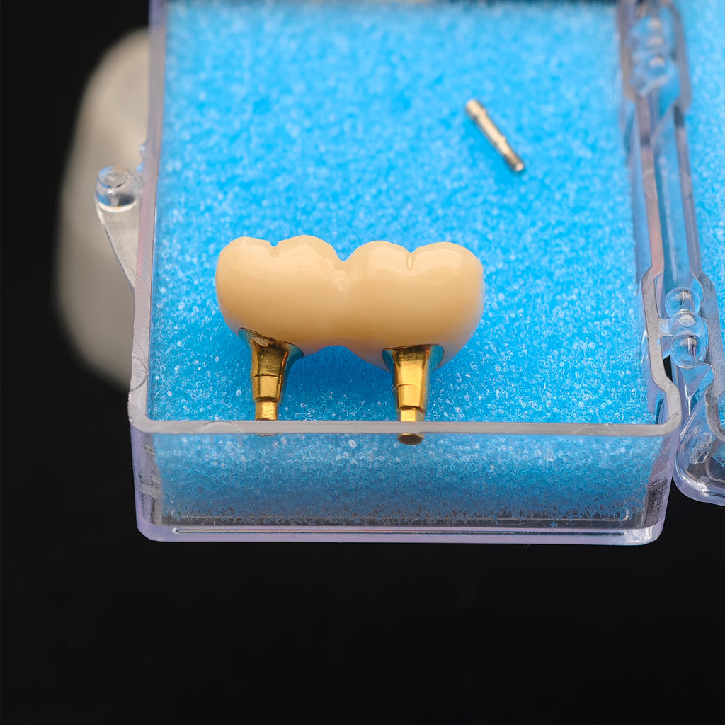 Custom Zirconia Implant Bridge
